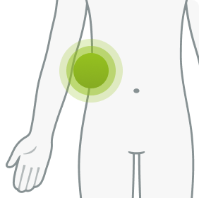 Illustration showing where Thoractomy should be placed